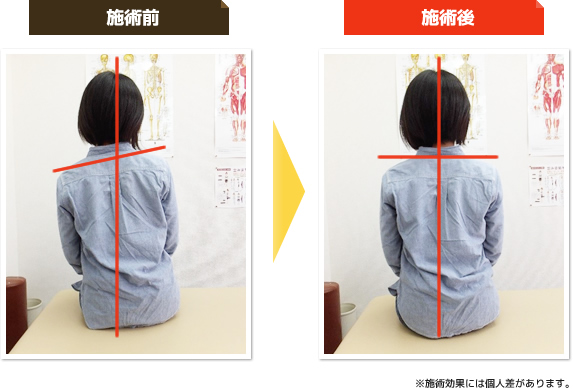施術前と施術後比較写真
